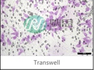 Transwell实验